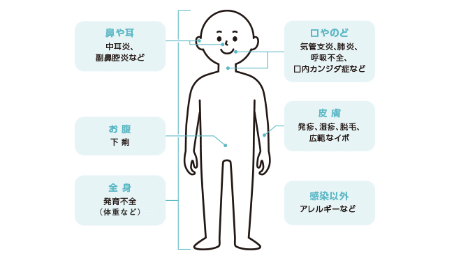 体のどこで症状が出やすいの？